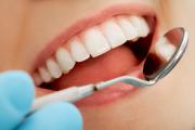 Dental Cleanings Image