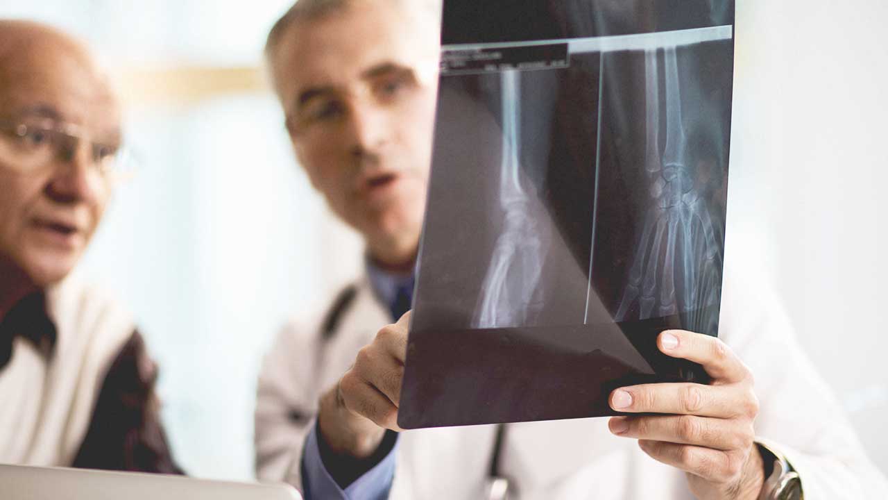 How Is Psoriatic Arthritis Diagnosed?