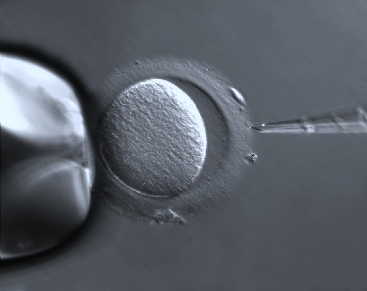 What Exactly Happens In IVF?