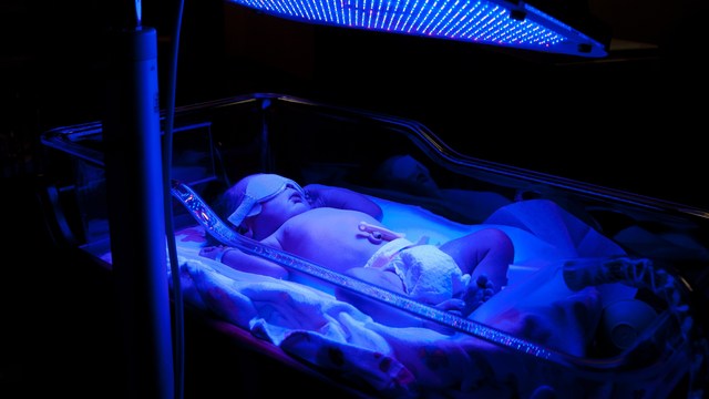 ABO Incompatibility and Jaundice: a Tough Start but Manageable 