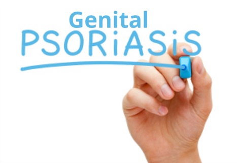 Genital Psoriasis contagious?
