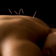 acupuncture may provide relief for pain such as sciatica 