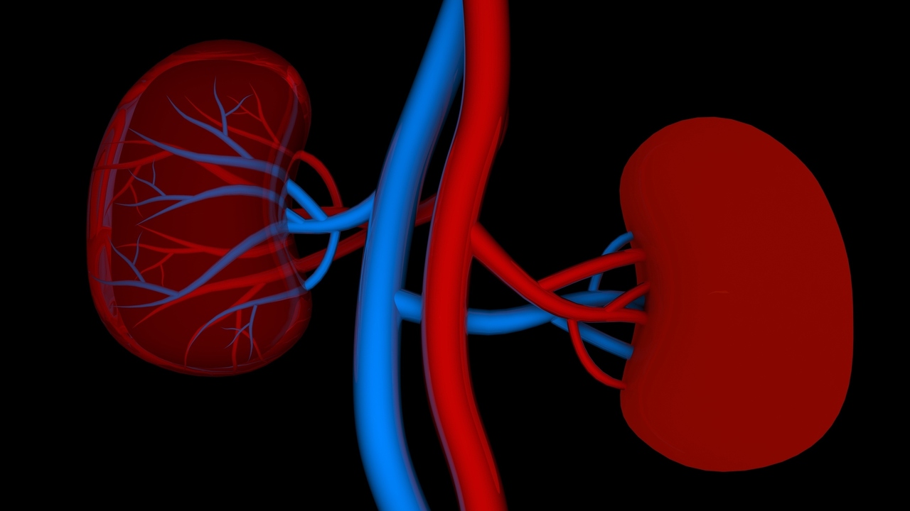Hemodialysis: Artificial Kidneys Cleaning Your Blood