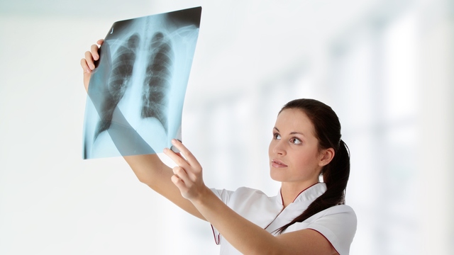 Lung Cancer Awareness Month: 5 Facts May Surprise You 