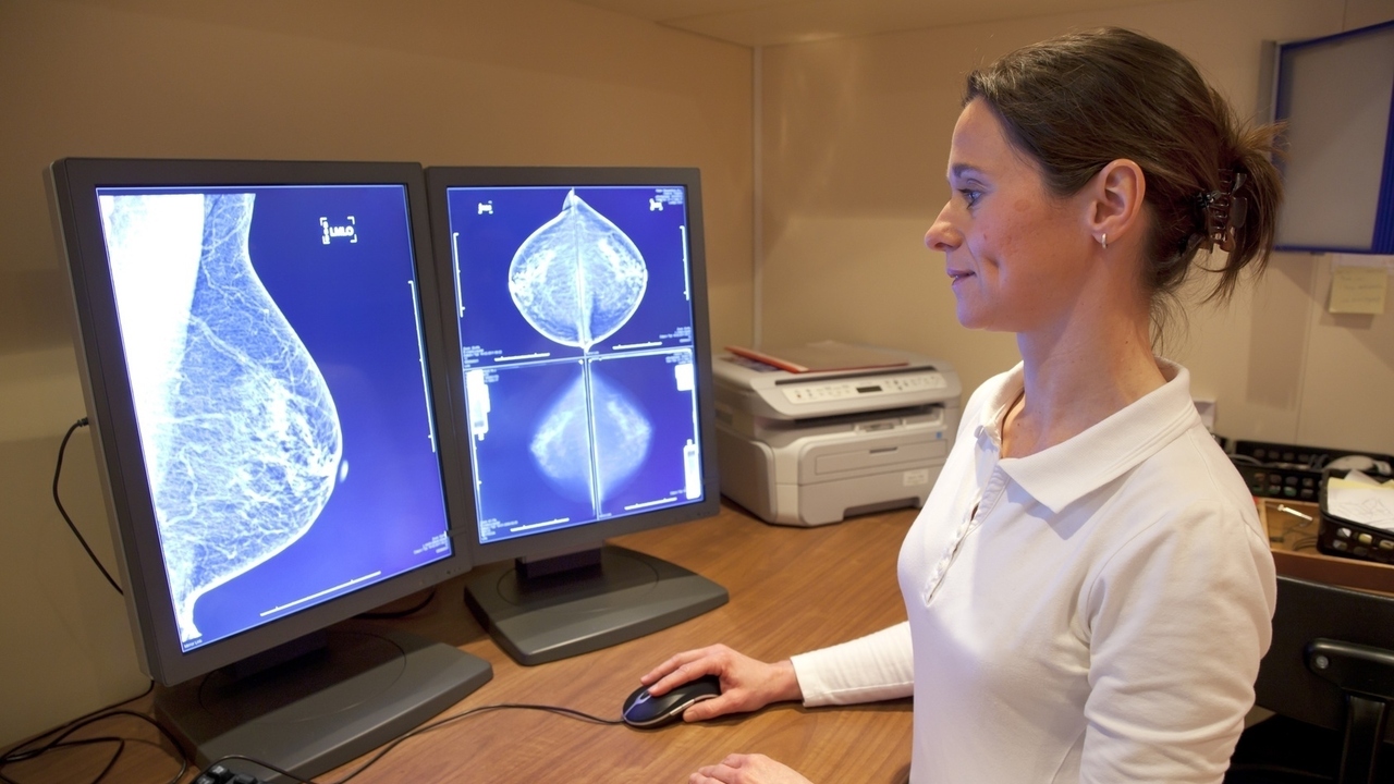 Is A Mammogram My Only Option for Breast Screening?