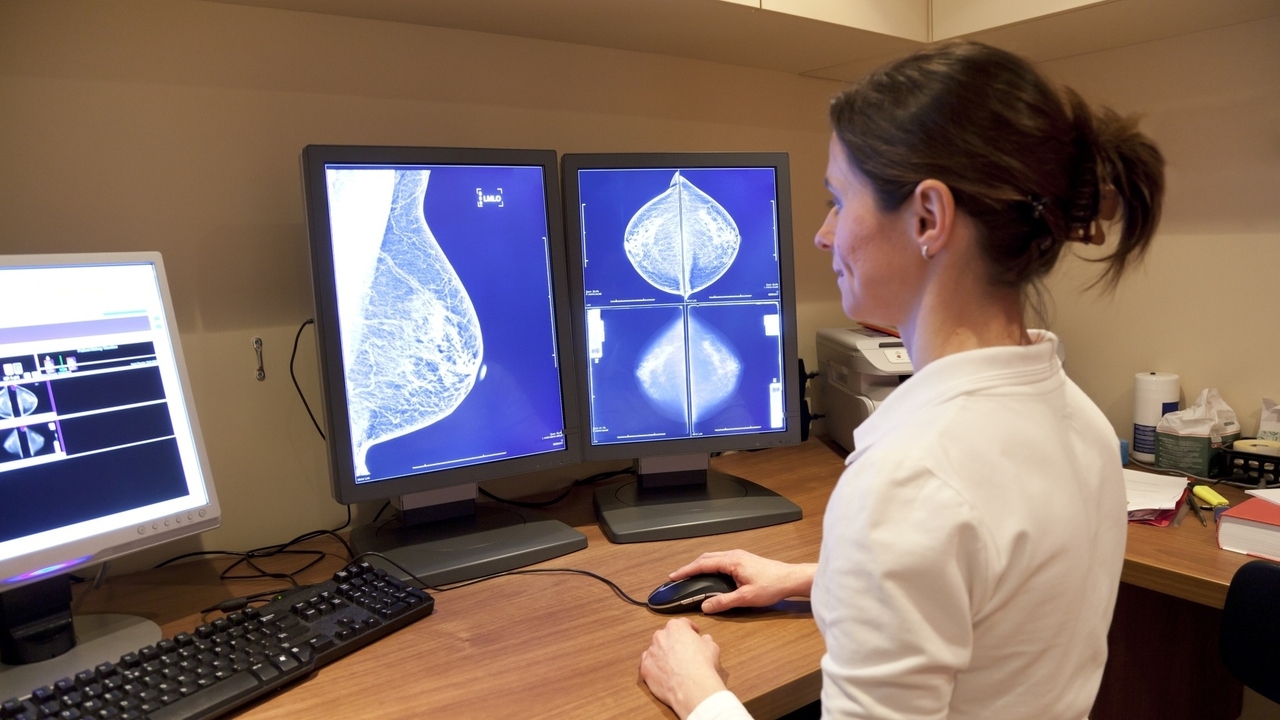 Mammograms May Help in Prevention of Heart Disease