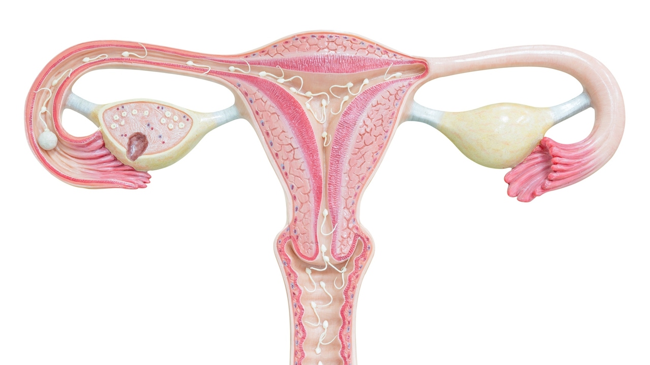 Ovarian Cysts: How Much Do You Know About Them?