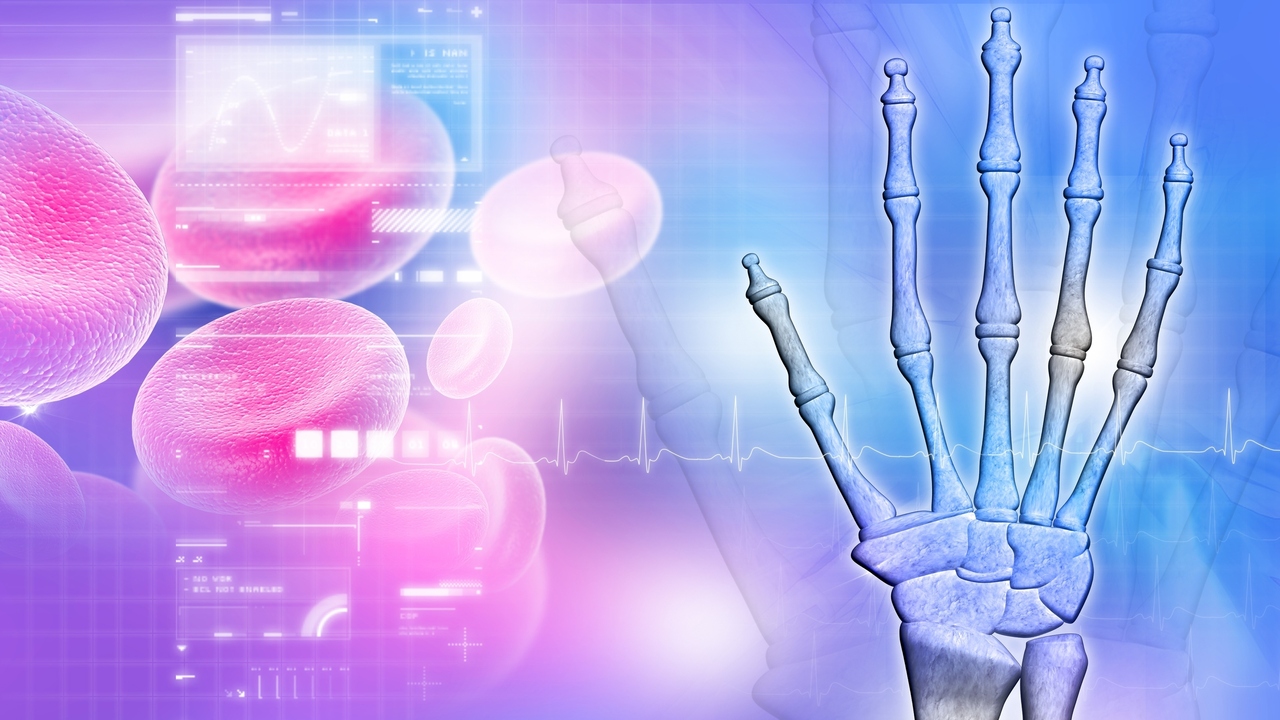 Rheumatoid Arthritis: 4 Warning Signs
